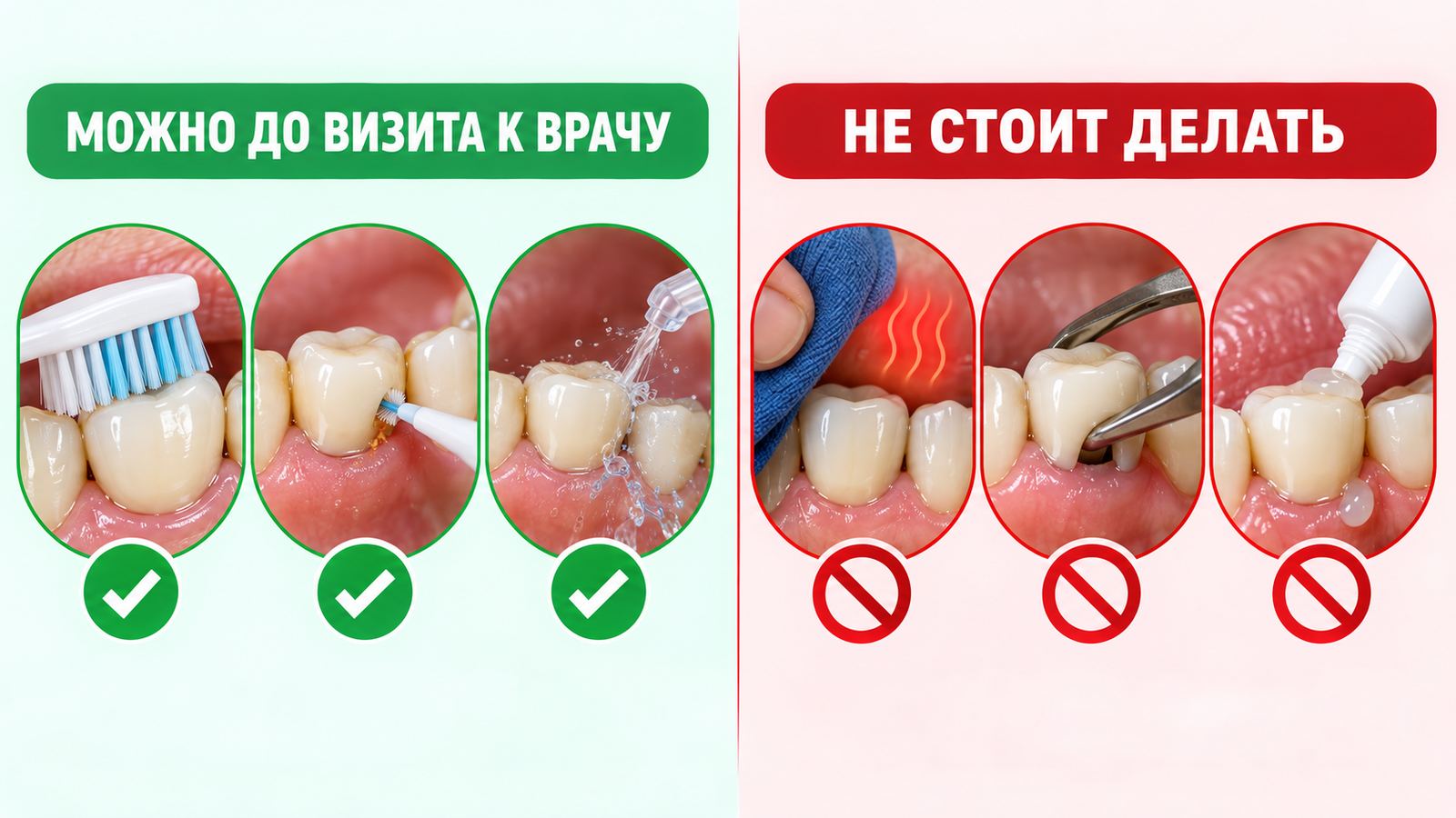 Болит десна под коронкой — что делать