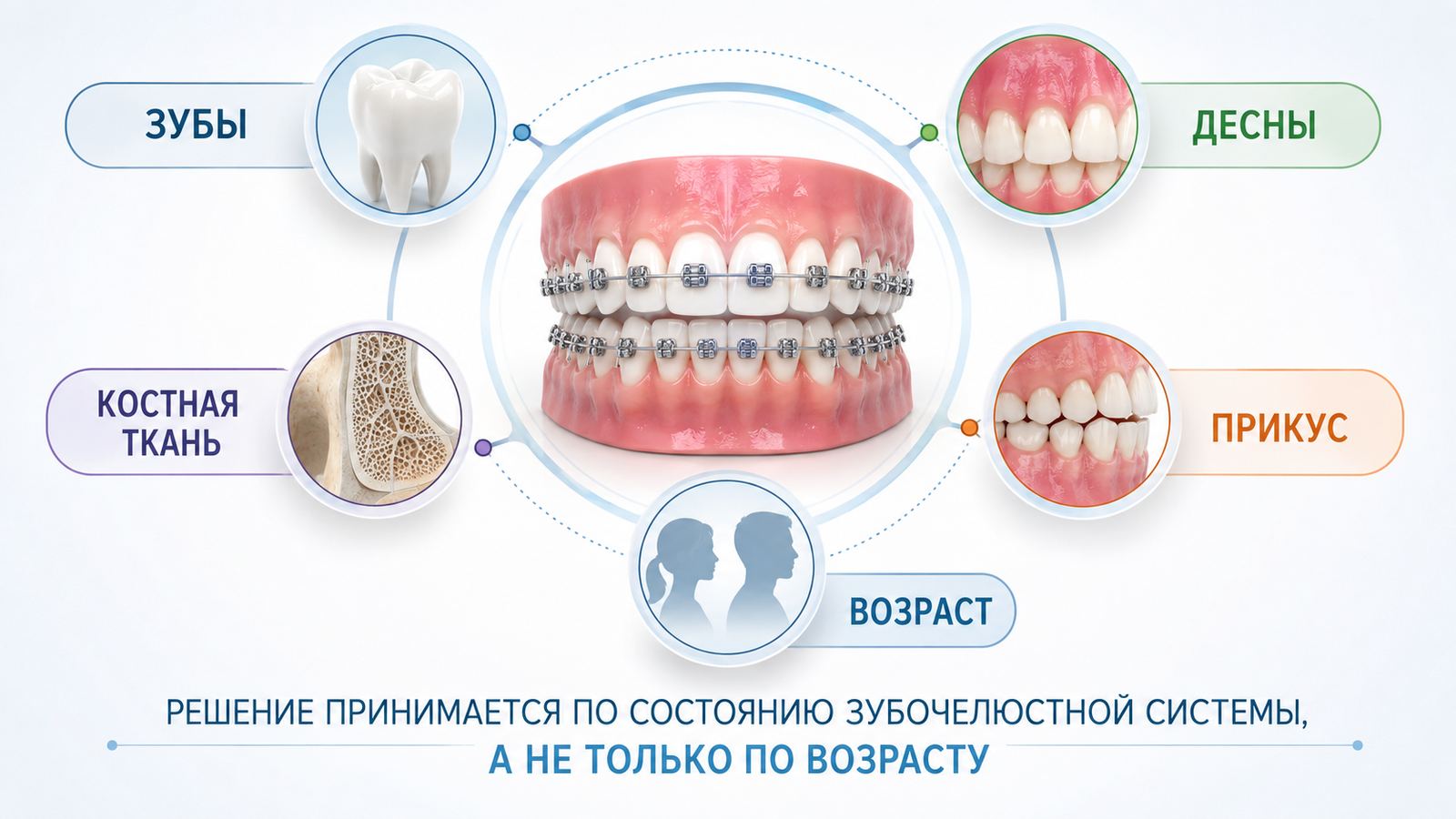Брекеты взрослым
