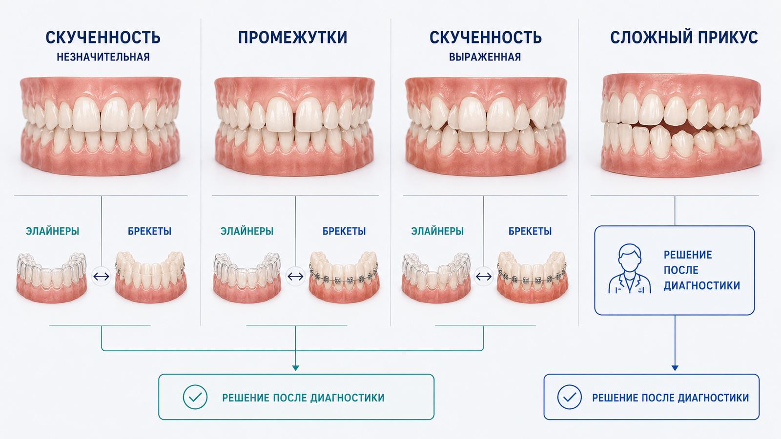 Элайнеры или брекеты