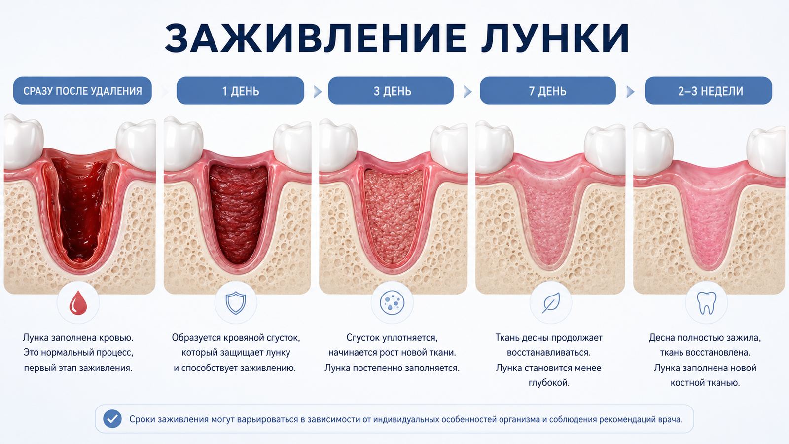 Лунка после удаления зуба