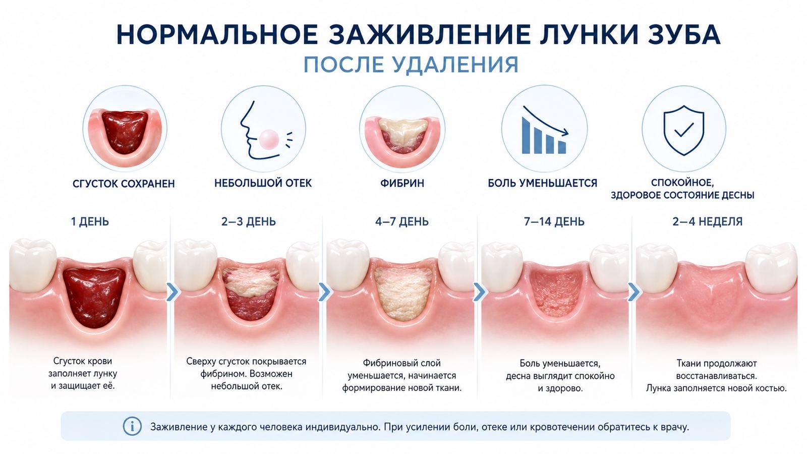 Лунка после удаления зуба