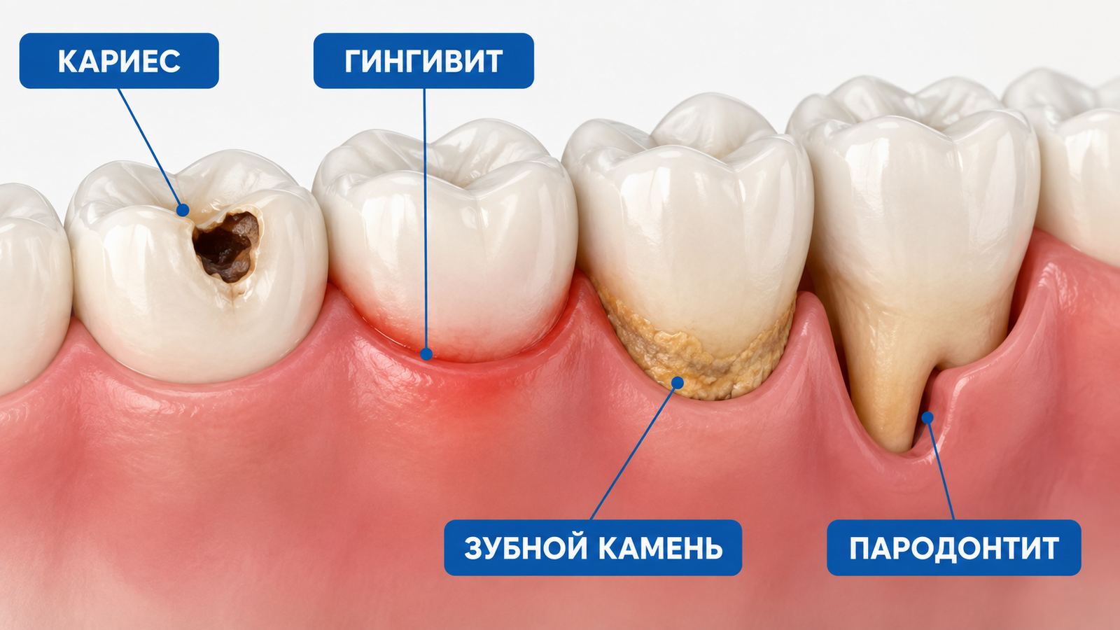 Неприятный запах изо рта: основные причины