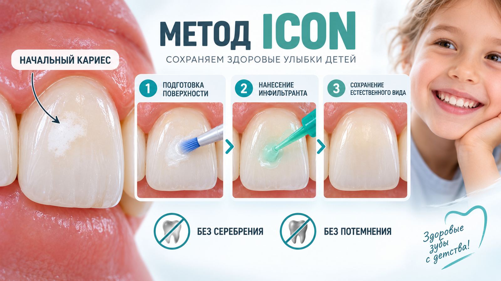 Серебрение зубов детям
