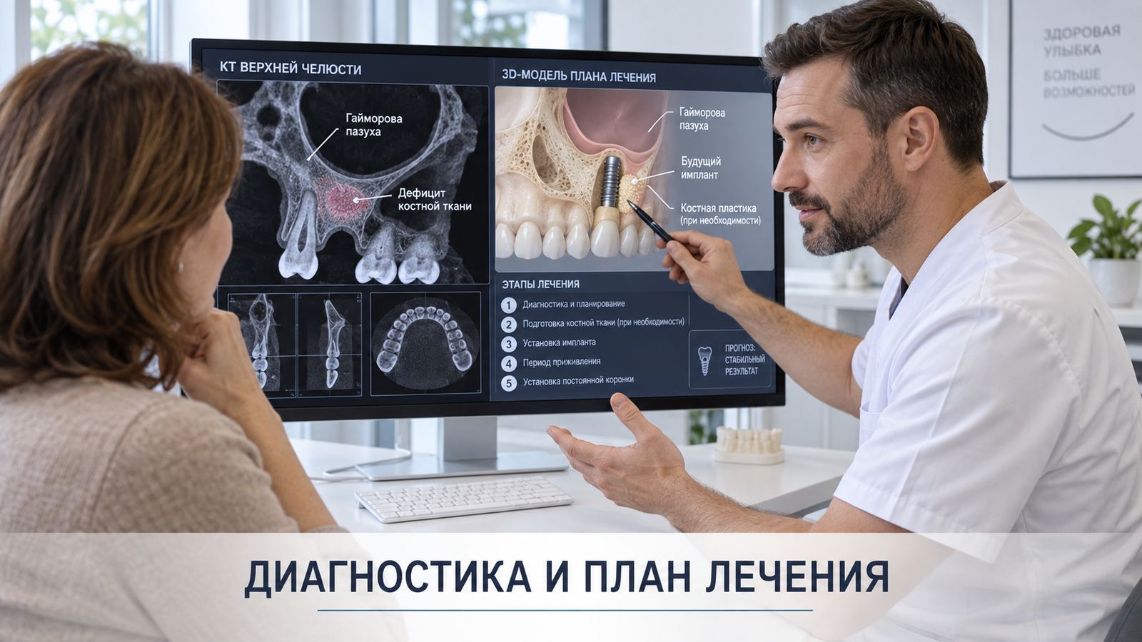 Синус-лифтинг